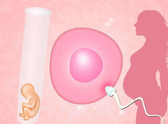 微创无痛人流手术