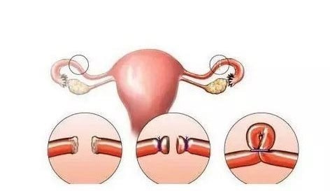 怀儿子的征兆验孕棒
