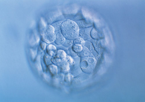 七个月胎位不正