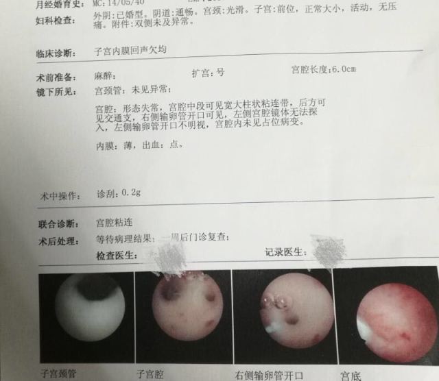 怀孕三个月的宝宝