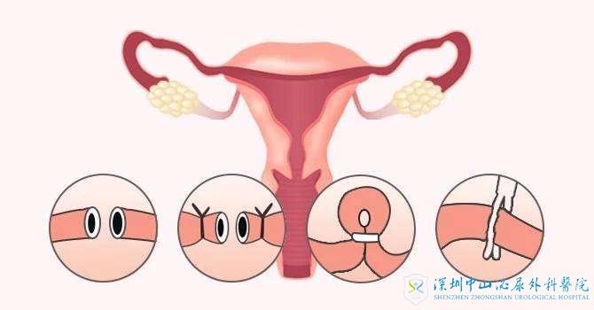 怀孕了下面出血了是怎么回事